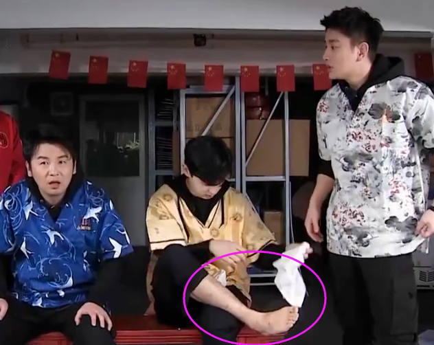 邓伦录极限挑战"鱼疗",谁注意他腿上的伤痕?说不心疼是假的