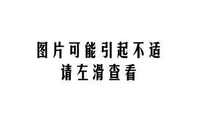 还有,不要以为产妇打了麻药就什么都不知道.
