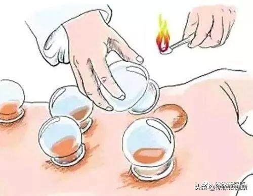 拔罐就是哪疼拔哪