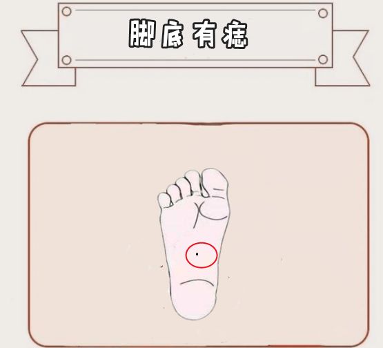 脚底有痣脚底有痣的人在相学中是易外出之相,这类人的机遇往往在远方