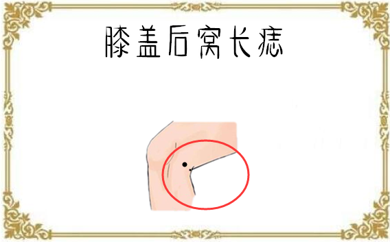 "千金难买5颗痣",藏而不露,个个万里挑一的好命