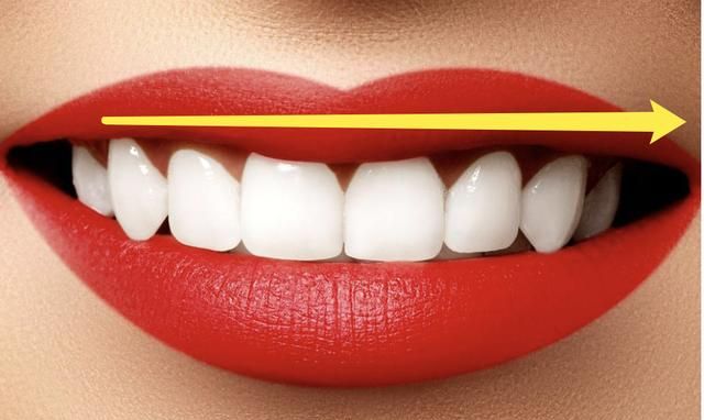 娜扎正面打半个娱乐圈,侧面却暴露"巫婆咬合"|牙齿|颌面|牙槽骨_新浪