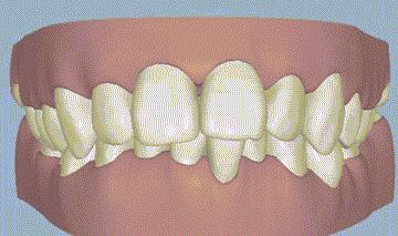 娜扎正面打半个娱乐圈,侧面却暴露"巫婆咬合"|牙齿|颌面|牙槽骨_新浪