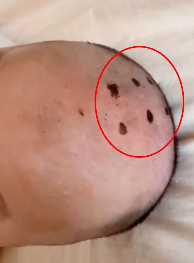 宝宝的囟门很脆弱,家长要注意保护