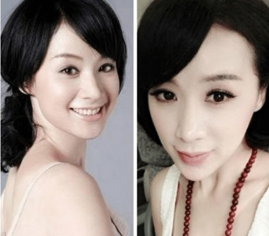 这就是整容的后果邓超杨幂曾为她配戏如今却沦落成这样