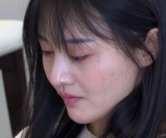 郑爽这是又动刀了全素颜上节目怼脸拍嘴角疤痕过于明显了