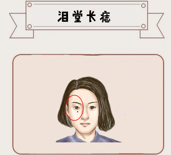 女人五颗烂桃花痣情债不断离婚率高婚后难安生