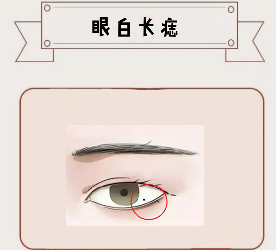 女人五颗"烂桃花"痣,情债不断,离婚率高,婚后难安生|婚后|桃花|眼白