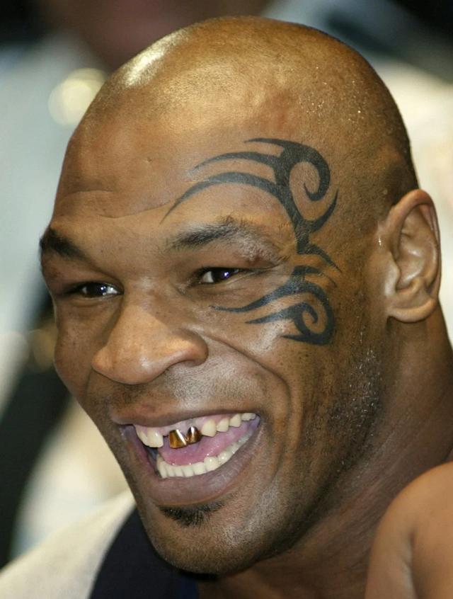 泰森接受干细胞治疗,尖端科技让他变年轻,54岁夺冠将破世界纪录