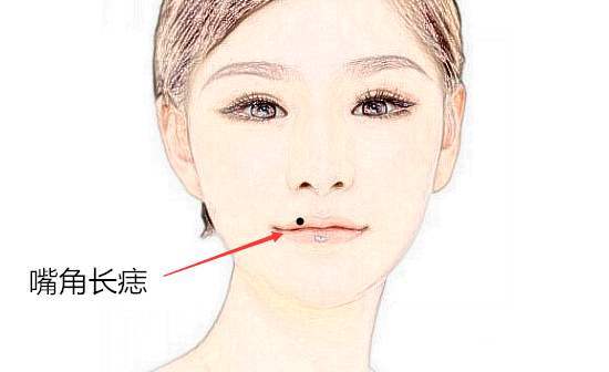 嘴巴上长痣有何寓意 解读嘴巴长痣的人一生运势