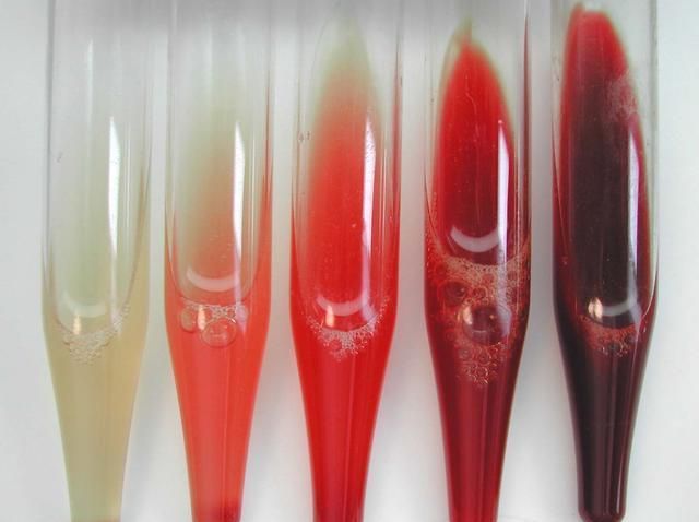 肾病不能拖,若上厕所有这3种异象,或是肾脏在"求救"|肾脏|尿液|肾病