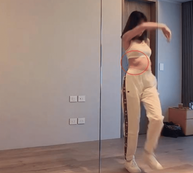 其实很多明星都有"肋骨外翻"的问题.