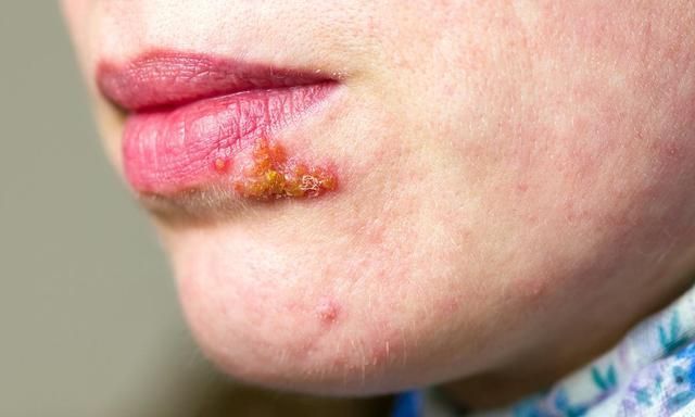 不一定!可能是4种疾病在"捣鬼"