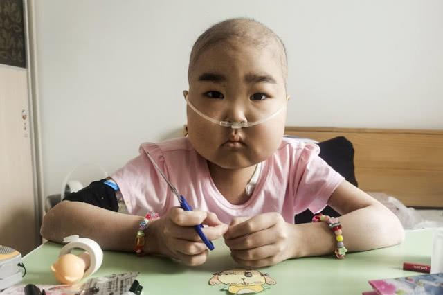 7岁"小萝莉"患重症4年样貌大变,今被医生禁食3个月瘦成皮包骨