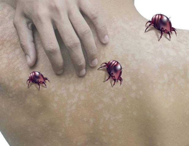 发现宝宝身上有这几个迹象并总是抓挠也可能是螨虫在作怪