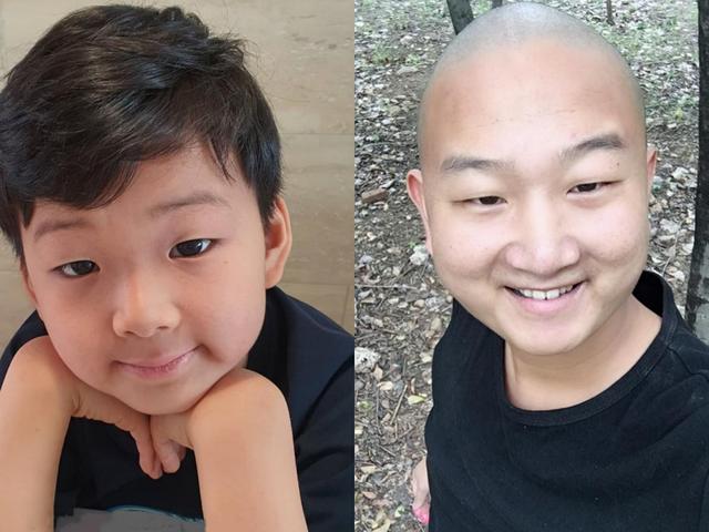 8岁宋民国长残了近照下巴变尖嘴唇干裂被指撞脸giao哥