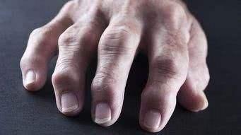 小时候经常掰手指老了会得关节炎吗告诉你到底有没有影响