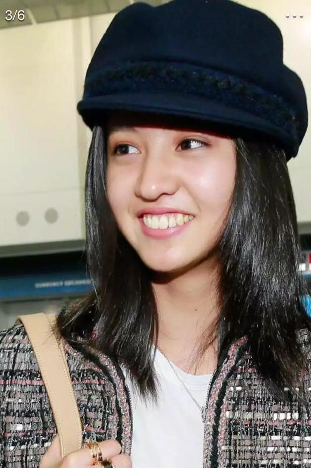 为什么女明星都爱整牙小s早期龅牙自卑佘诗曼以前嘴巴好凸