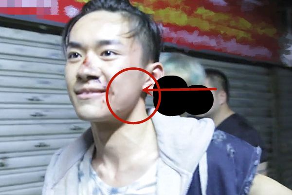 易烊千玺演小北时,本以为脸上的手印是特效妆,没想到真的被打了