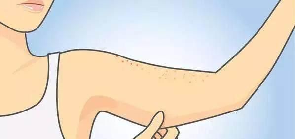 怎么才能弄掉鸡皮肤(有什么办法可以去掉鸡皮肤) 怎么才能弄掉鸡皮肤(有什么办法可以去掉鸡皮肤)