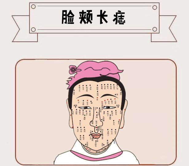身体6颗巨富痣藏而不漏只要有一颗辈辈发家代代富