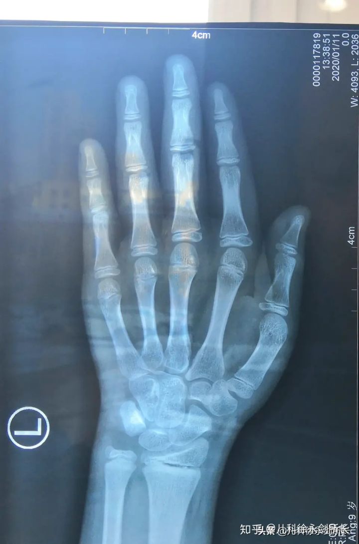 生长发育科徐永剑所长