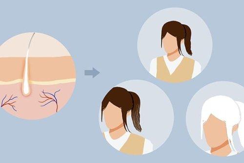 经常拔白头发会有什么后果