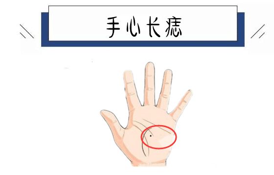 身体5颗福禄痣藏而不露晚年多子多孙房产上千万