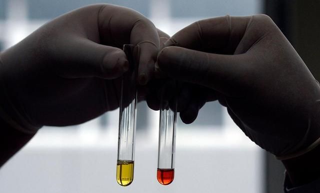 而且,对于一些高血脂患者来说,如果血脂过高的话,很容易就会导致血液