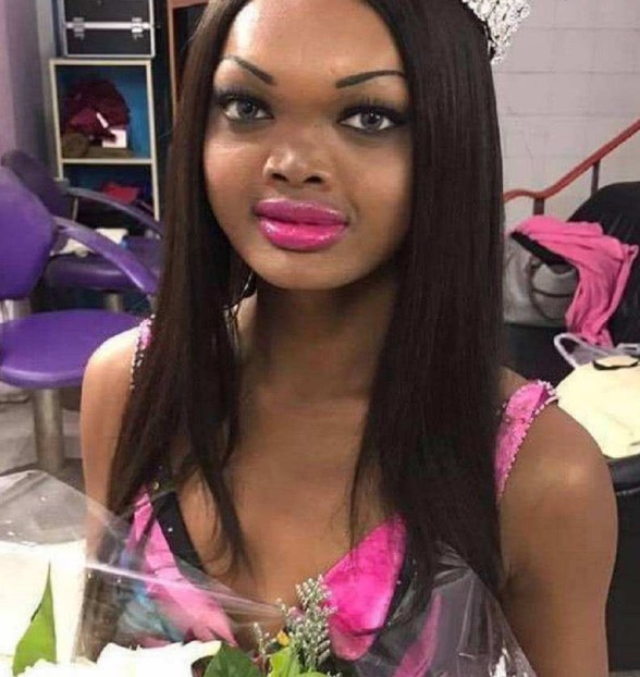 世界上最"丑"的模特,身材堪称顶级天使,但脸却是终极魔鬼!