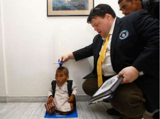 目前像这种导致人体异常长高,或者是畸形矮小的疾病,还没有什么特效药