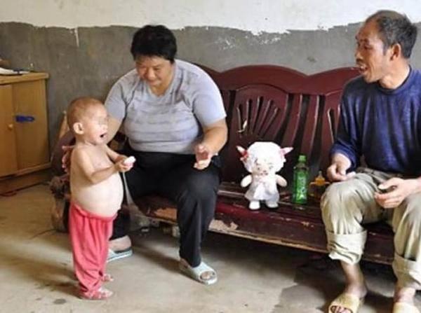 小孩肚子越来越大检查后才发现肚子里有这个东西