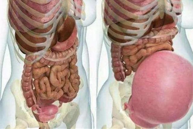 孕妇"平躺"胎儿易缺氧,一定要"左侧卧"?这才是睡觉最佳姿势