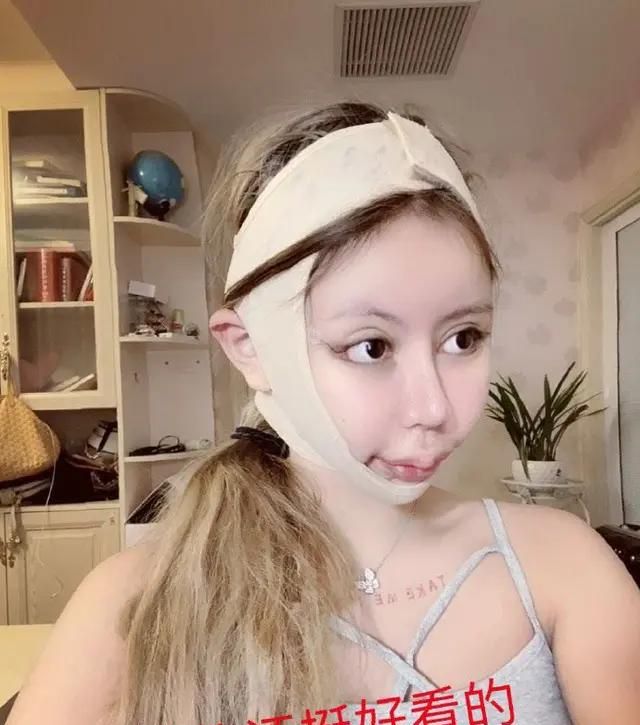 16岁网红小z娜娜3年整容超60次突破人类极限只为变真人芭比