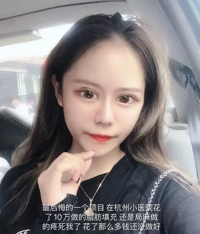 16岁网红小z娜娜3年整容超60次突破人类极限只为变真人芭比