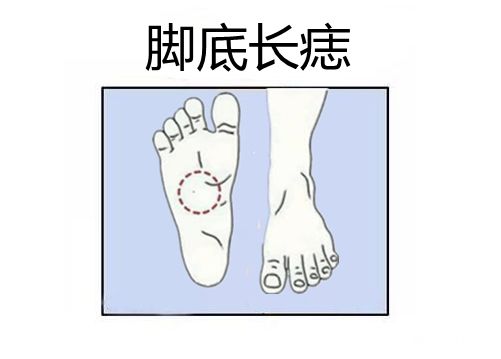 身体6颗吉痣十人九富个个财大气粗兜财旺子孙