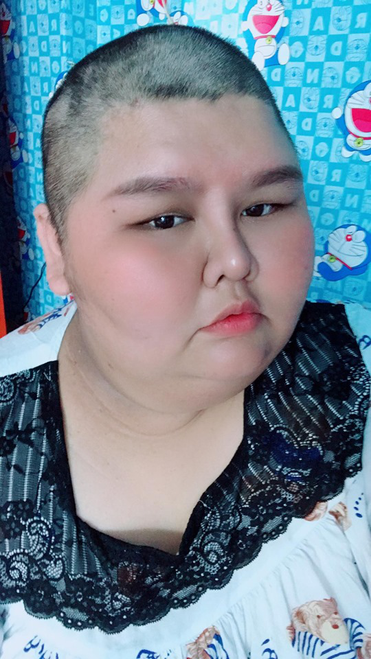 260斤女子嫁140斤丈夫曾引热议,如今她剃成光头丈夫支持