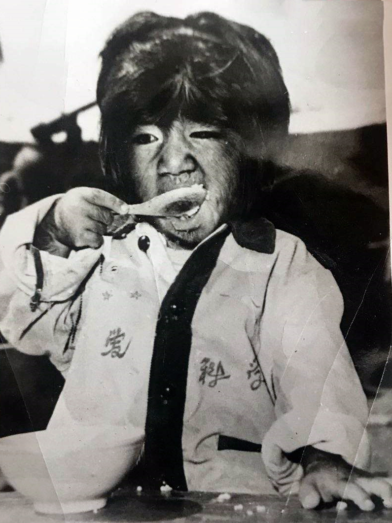 "毛孩"于震寰:从小浑身长满黑毛,43年前火遍全国,如今怎样了