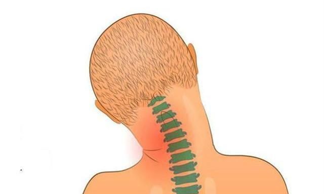 痉挛性斜颈症状类型 痉挛性斜颈怎么治疗最有效