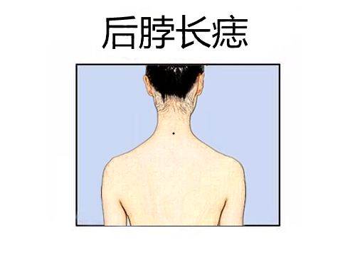 事业痣,身体此处长吉痣,升官发财快,横财运强,个个成龙成凤