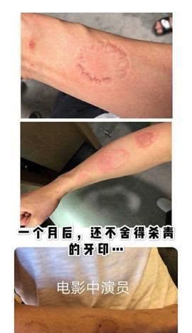 拍戏将男配咬成重伤