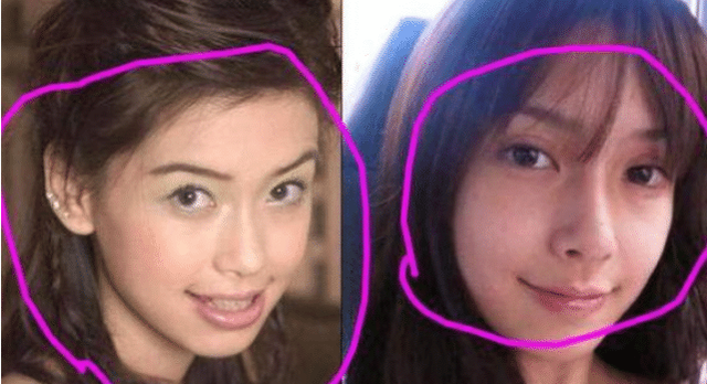 杨颖15岁丑照曝光被质疑整容回应早知道整牙前不拍那么多照片