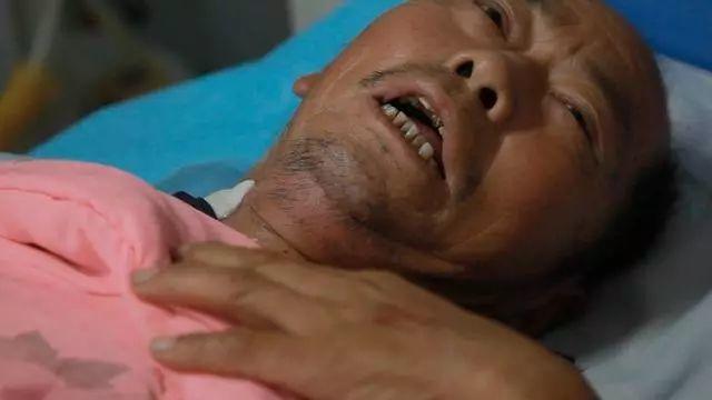 62岁老人,突发脑出血,全身瘫痪,医生痛斥:一把年纪,不知节制