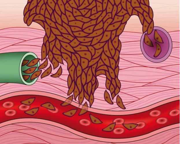 血管怕堵,经常做这3件事的人,血管通畅不堵塞,不会太差