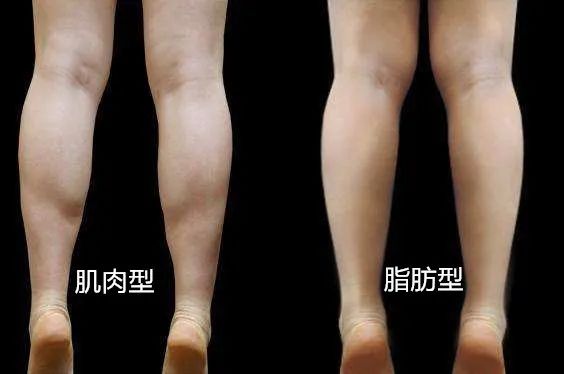 吴昕近照简直像换了个人,大象腿变"山药腿" ,网友: 逆袭了