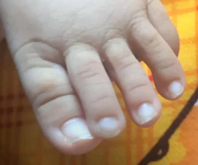 宝宝脚趾比手指还长,宝妈欲哭无泪,网友笑翻:分不清是手还是脚