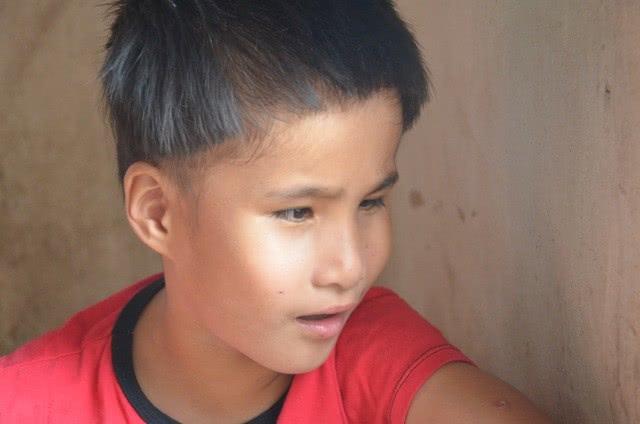 女子18岁早产生下双胞胎女儿, 结果两个娃都患脑瘫还双目失明