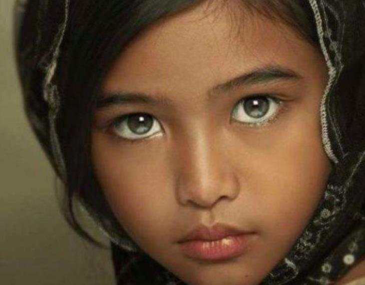 此印度小女孩不一般,有着"三只眼睛",专家:无法解释!