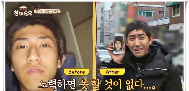 黄光熙:关于整容,是母亲给了我勇气!