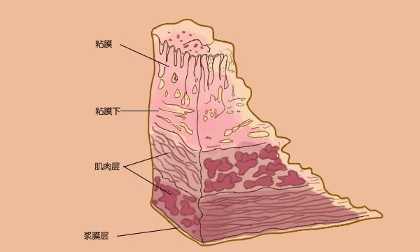 胃液酸性那么强,为何没把胃腐蚀掉?